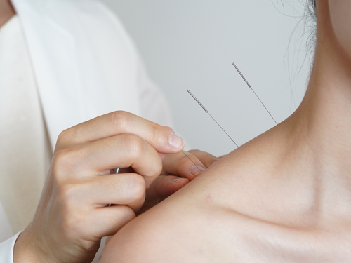 Dia Mundial do Acupunturista