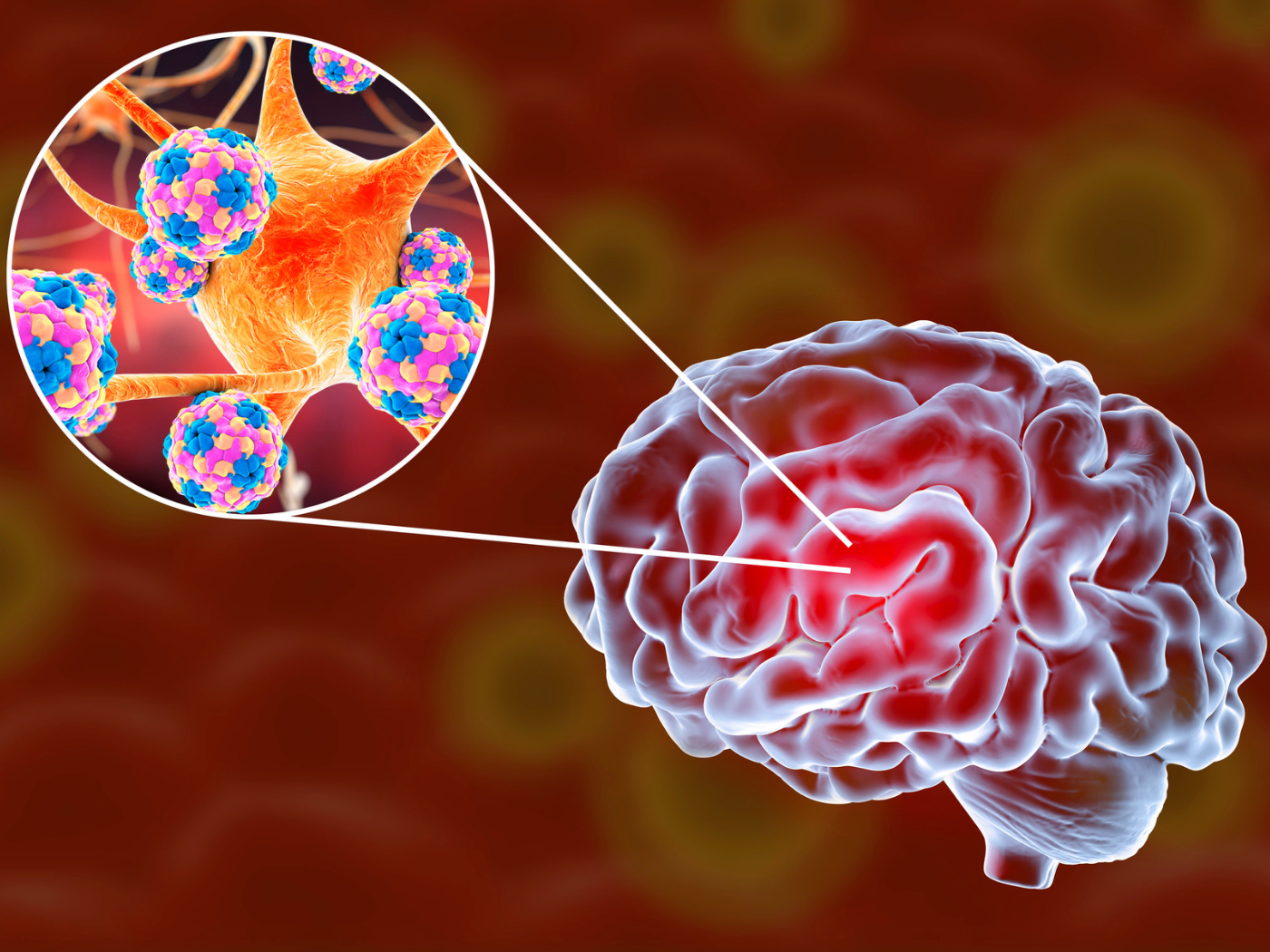 Dia Mundial da Encefalite
