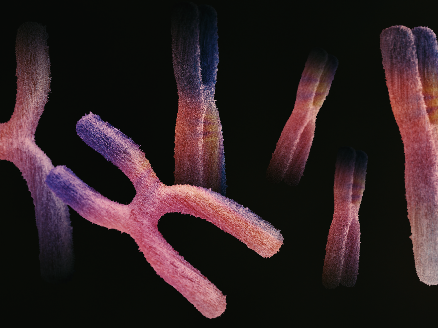 Dia Mundial da Consciencialização da Síndrome de Potocki-Lupski