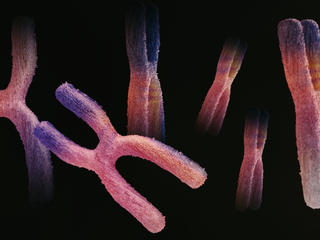 Dia Mundial da Consciencialização da Síndrome de Potocki-Lupski