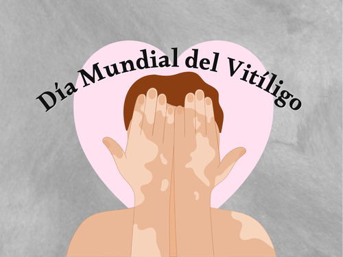 Día Mundial del Vitíligo