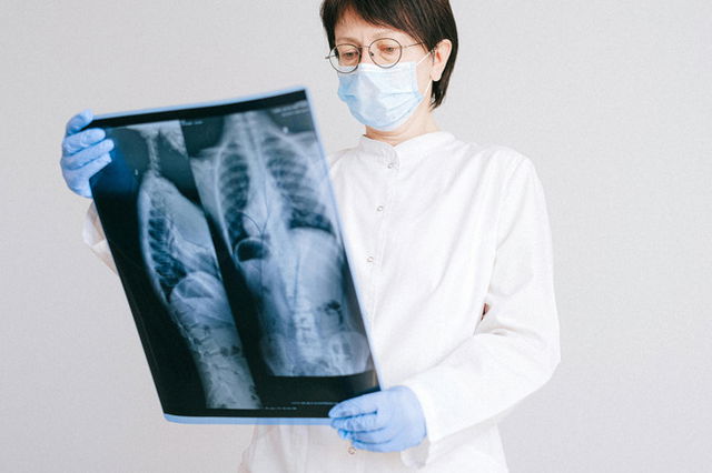 A doctor looking at X ray