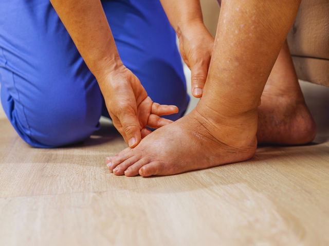 médico examinando paciente com pés inchados