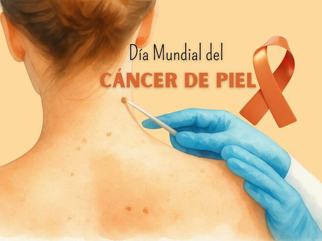 Día Mundial del Cáncer de Piel