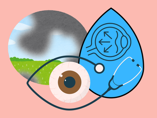 Día Mundial del Glaucoma